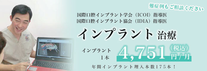インプラント